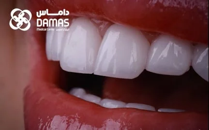 testimoial-6d- Elite smile
