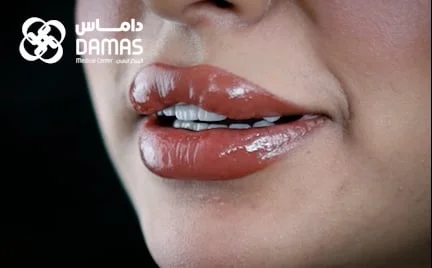 testimoial-6d- Elite smile